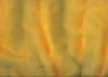 Torginol (TOP1420)